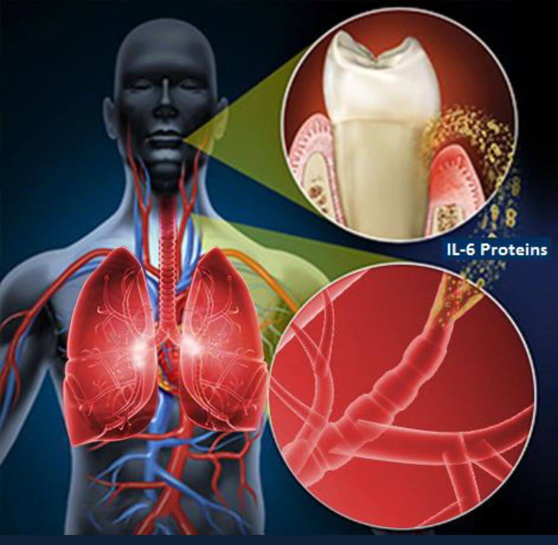 cardiovascular health and gum disease