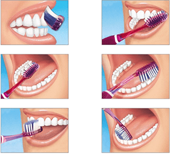 Home Remedies For Gum Recession