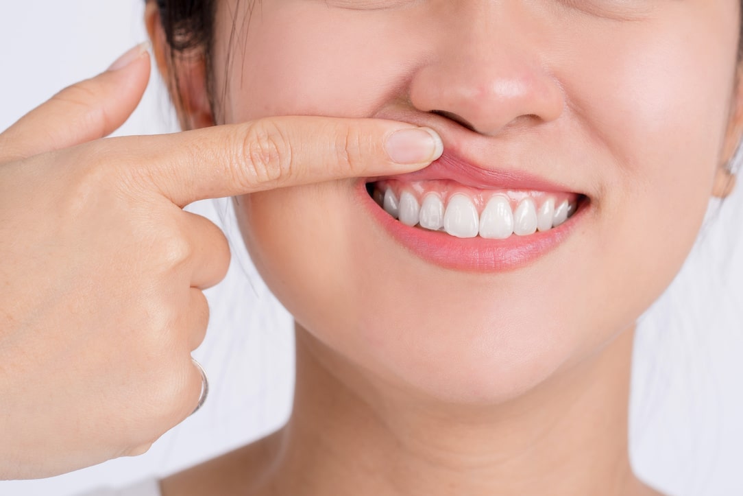 antibiotics for treating gum disease