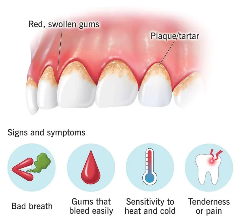 Causes and Risk Factors